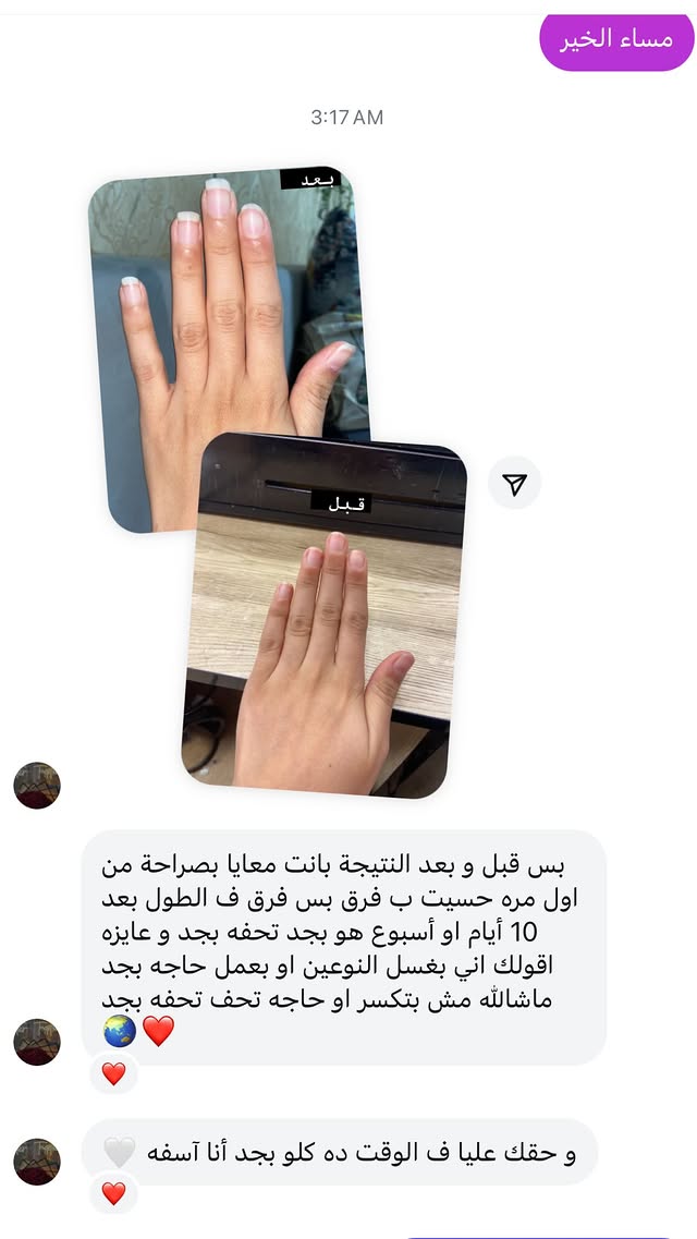 تجربة عميل